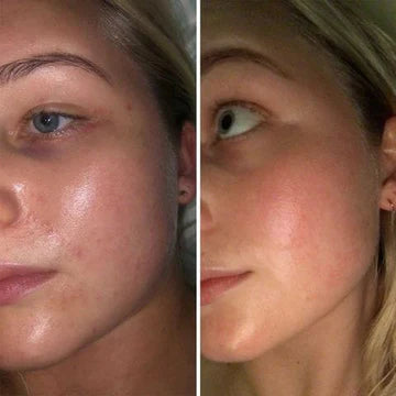 Rotlicht Gua Sha