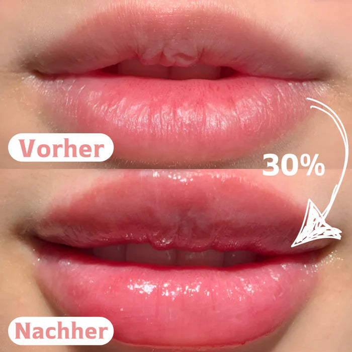 Lip Plumper Bundle